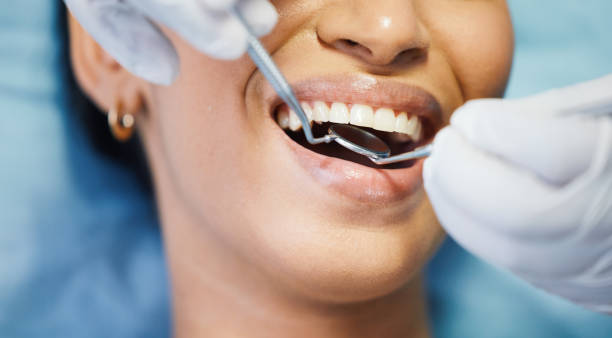 Best Emergency Dental Care for Broken or Chipped Teeth in Thornville, OH